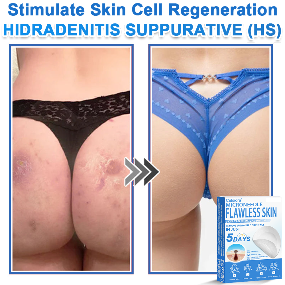 ☀️Celsiora® 2-in-1 Microneedle & Hydrocolloid Patch | Raised Moles,Acne,  Flat Warts & Skin Tags Remover | Improves Wrinkles, Scars & Blemishes | Invisible Star Pimple Patches for Face & Body