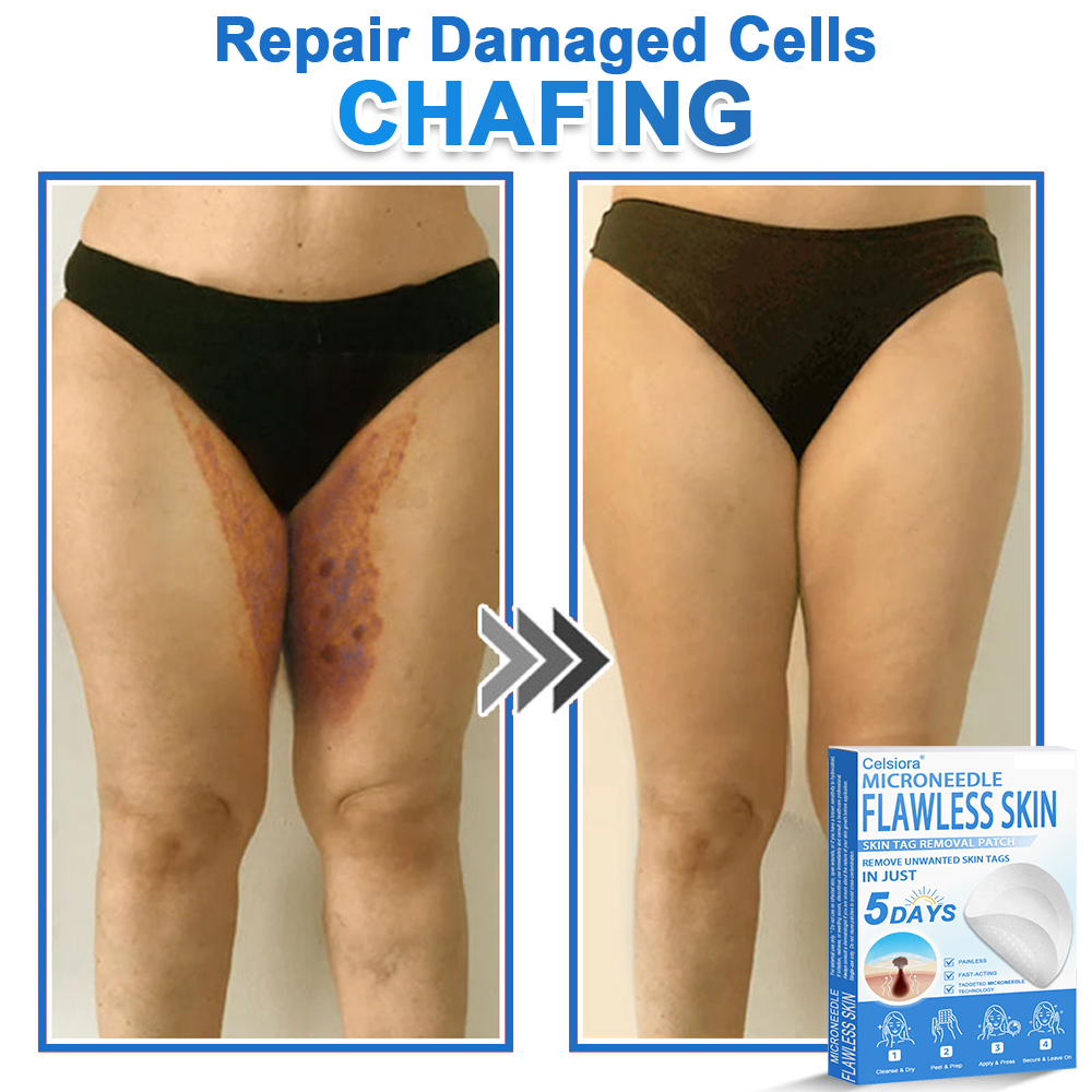 👩‍⚕️Celsiora® 2-in-1 Microneedle & Hydrocolloid Patch | Raised Moles,Acne,  Flat Warts & Skin Tags Remover | Improves Wrinkles, Scars & Blemishes | Invisible Star Pimple Patches for Face & Body