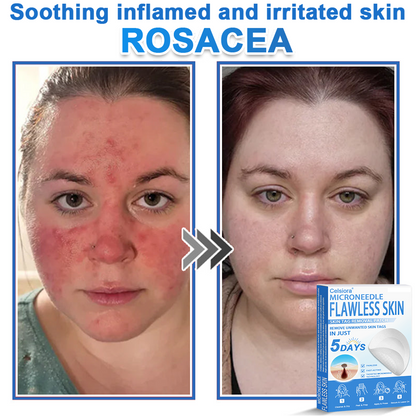 ☀️Celsiora® 2-in-1 Microneedle & Hydrocolloid Patch | Raised Moles,Acne,  Flat Warts & Skin Tags Remover | Improves Wrinkles, Scars & Blemishes | Invisible Star Pimple Patches for Face & Body
