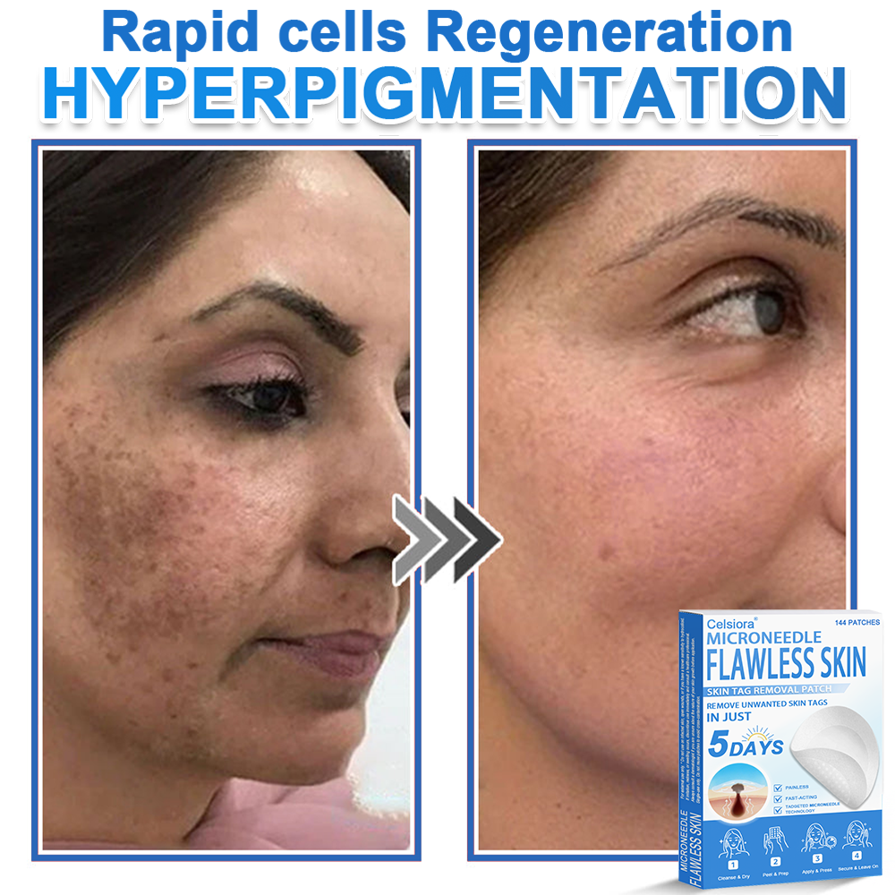 ⭐Celsiora® 2-in-1 Microneedle & Hydrocolloid Patch | Raised Moles,Acne,  Flat Warts & Skin Tags Remover | Improves Wrinkles, Scars & Blemishes | Invisible Star Pimple Patches for Face & Body